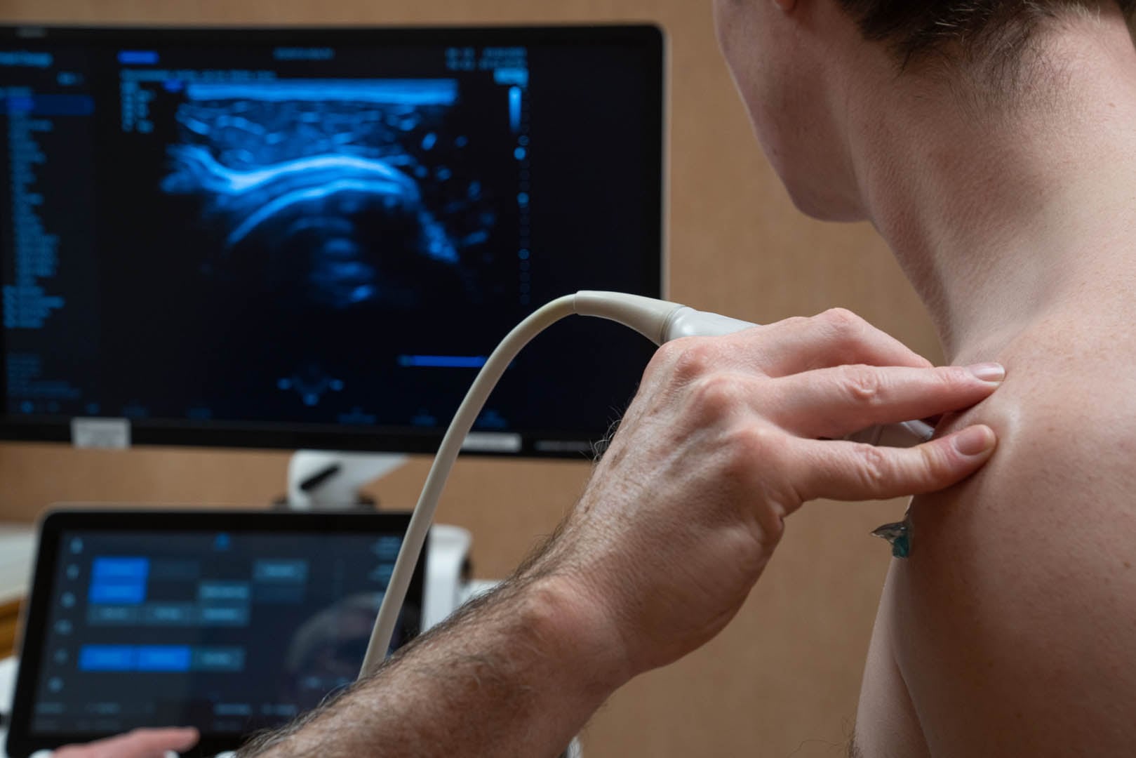 A medical professional performs an ultrasound scan on a patient's shoulder. The patient's back is partially visible, and the ultrasound monitor displays an image of the shoulder's internal structures. Another monitor shows interface controls and readings.