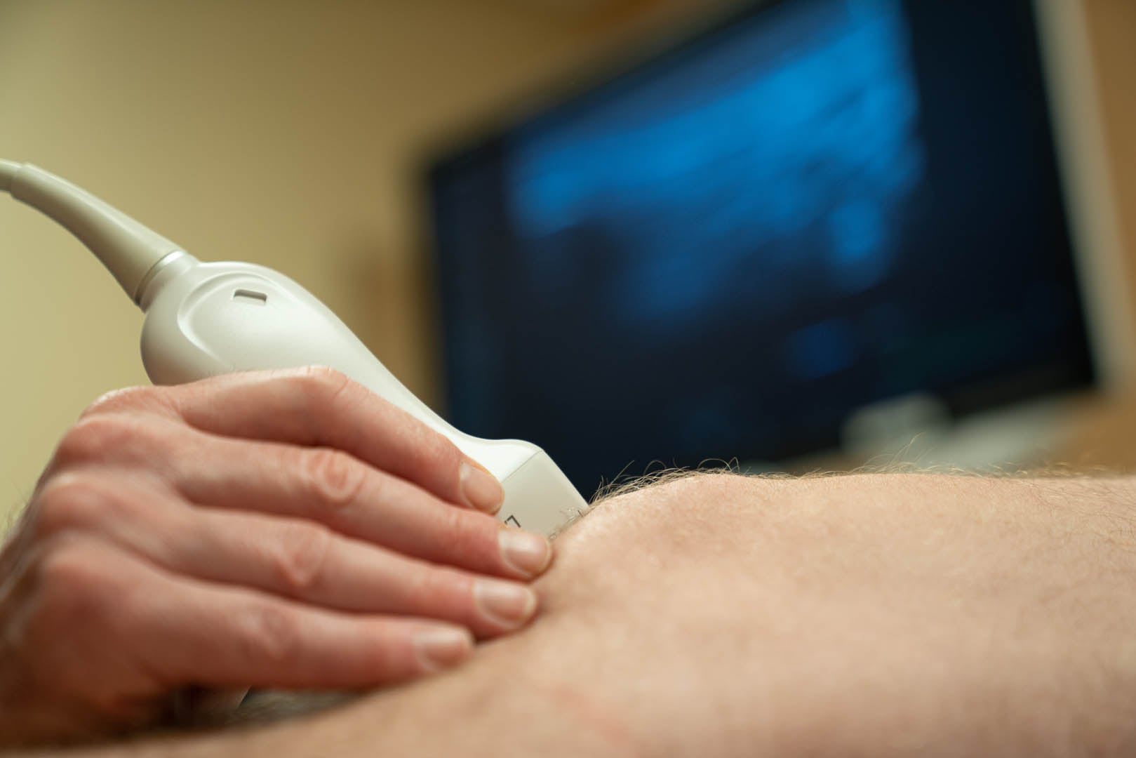 A close-up of a medical professional's hand holding an ultrasound probe against a patient's knee. The background shows a blurry monitor displaying the ultrasound image. The scene depicts a medical examination of the knee joint.