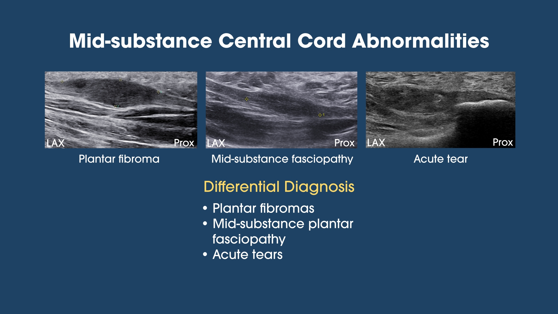 Mid-substance Central Cord Abnormalities