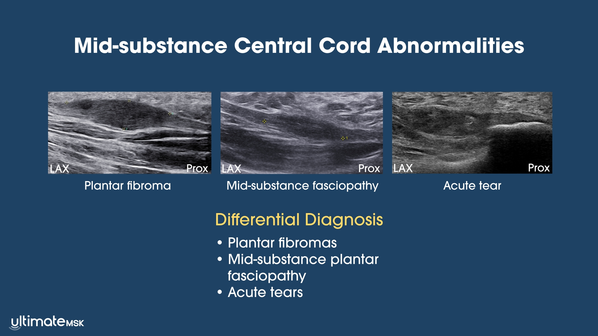 Mid-substance Central Cord Abnormalities